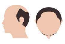 hair-thumb-step-12