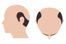 hair-thumb-step-13