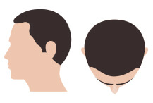 hair-thumb-step-2