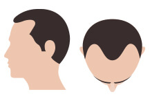 hair-thumb-step-3