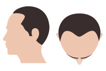hair-thumb-step-4