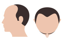 hair-thumb-step-5