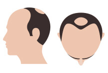 hair-thumb-step-6