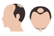 hair-thumb-step-7