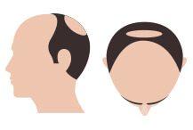 hair-thumb-step-9
