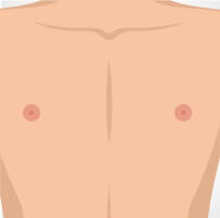 seborrhoeic-thumb-1