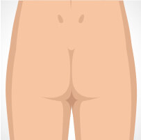 seborrhoeic-thumb-3