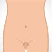 seborrhoeic-thumb-5