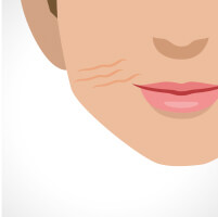 warts-img-4