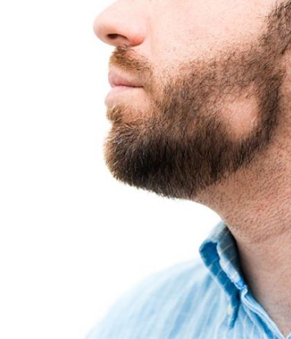 Did you just spot a bald spot in your beard