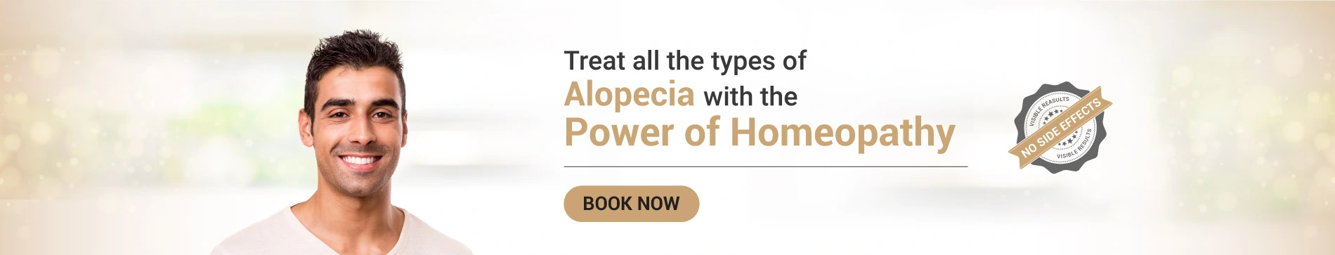 Alopecia Areata