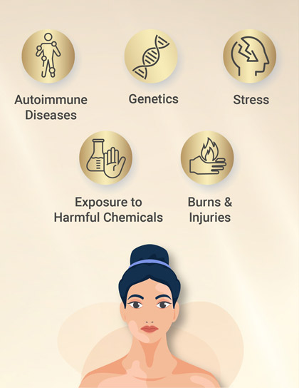 Vitiligo Treatment
