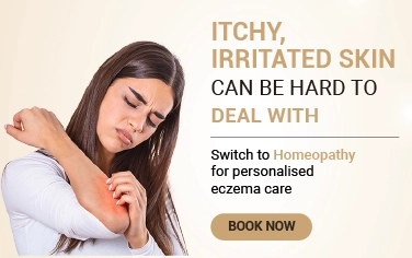 Eczema Treatment
