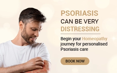 Psoriasis Treatment
