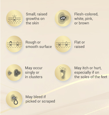 Symptoms of Warts