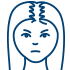 Mob Female Pattern Baldness