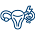 Mob PCOS