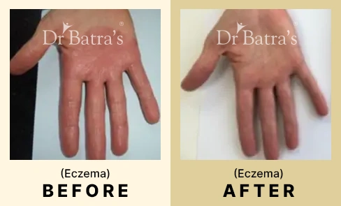 02 Before After