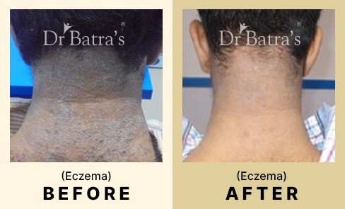 03 Before After