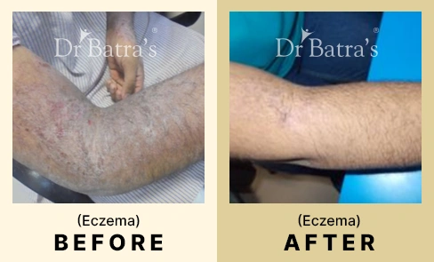 04 Before After