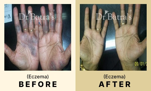 05 Before After