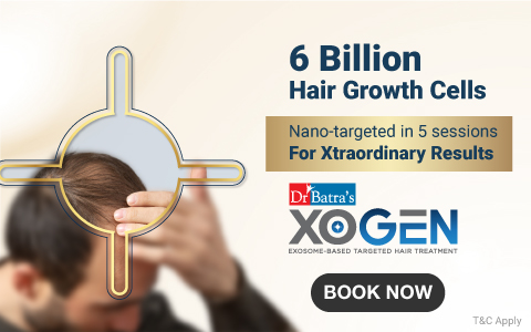 Xogen