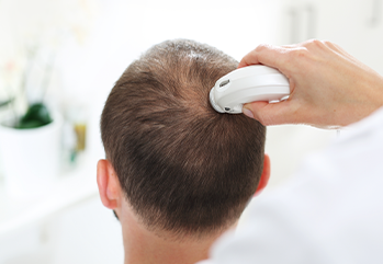 Hair Treatment, Hair Loss Treatment Homeopathy For Men & Women