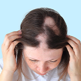Alopecia Treatment