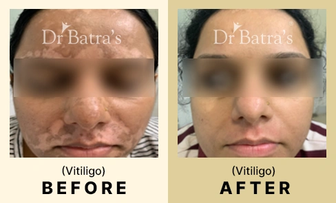 02 Before After