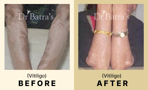 03 Before After