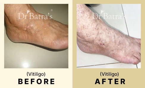 05 Before After